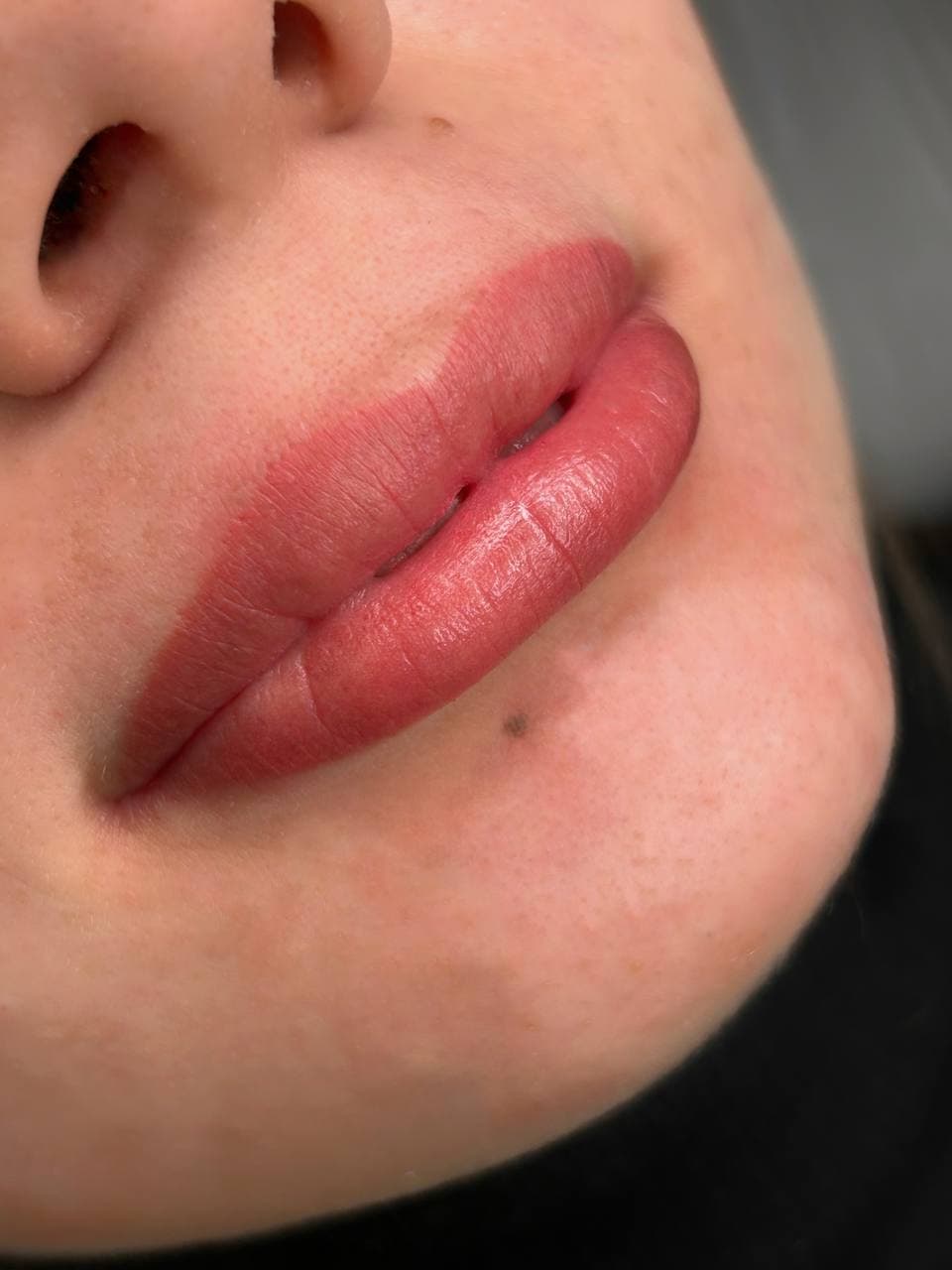 Lips 1