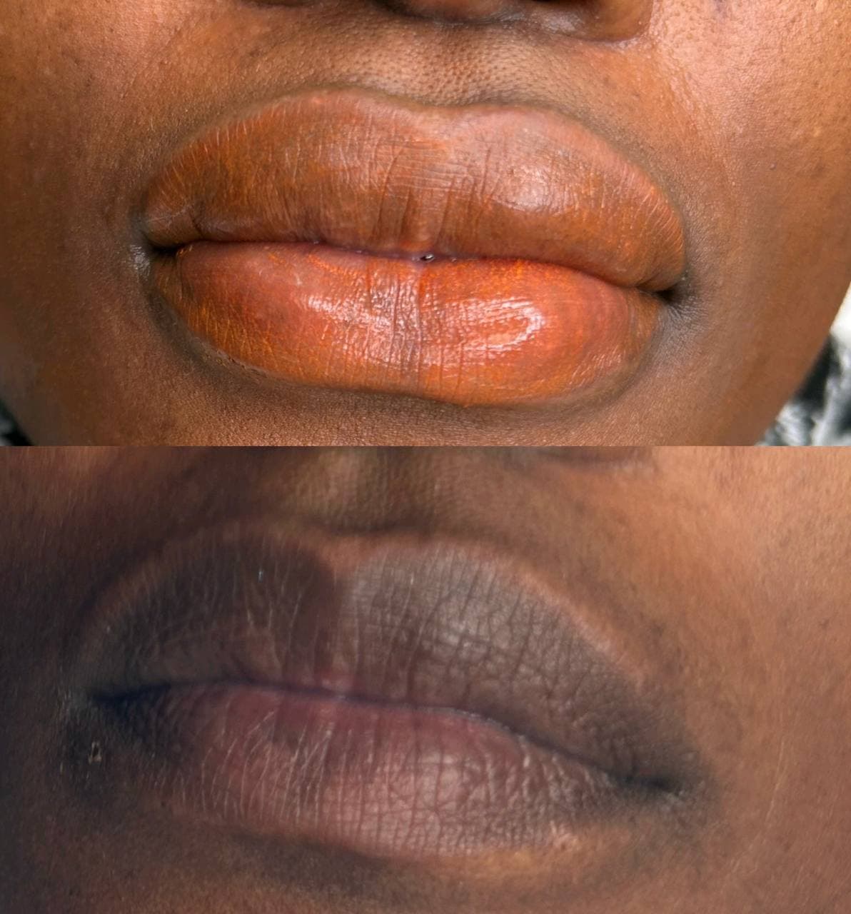 Lips 2